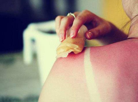 如何恢復曬后皮膚?曬后肌膚修復的方法