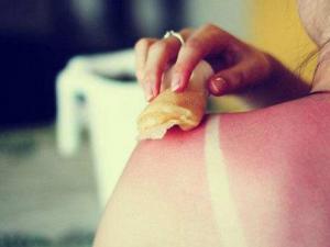 如何恢復曬后皮膚？曬后肌膚修復的方法