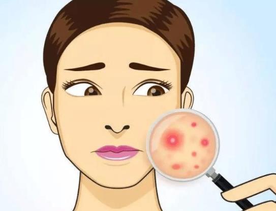 為什么打完九價會長痘?美國治療青春痘的新藥上市了嗎