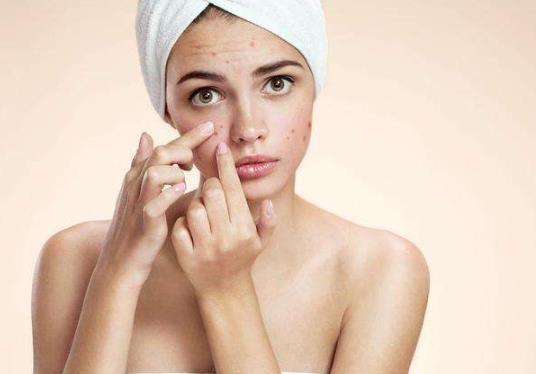 青春痘疫苗在哪里接種?青春痘疫苗2023年出來是真的嗎