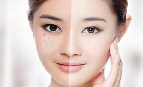 能夠有效預(yù)防青春痘的十大方法 有預(yù)防青春痘效果的食物