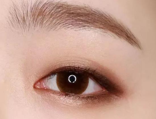 割雙眼皮要動刀嗎?埋線雙眼皮可以永久保持嗎?