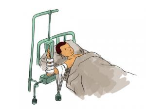 骨折病人吃什么好?骨折愈合的時間