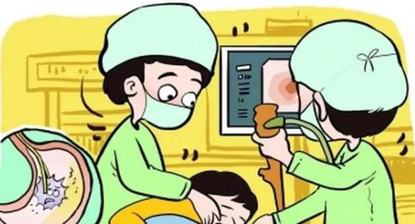 什么是無痛胃腸鏡無痛技術?無痛胃腸鏡的檢查過程及適應癥狀