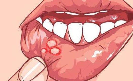 嘴唇起泡的原因有哪些?嘴唇起泡怎么辦?