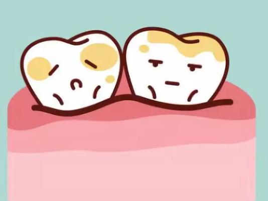 牙結石是如何形成的?牙結石可以有多大