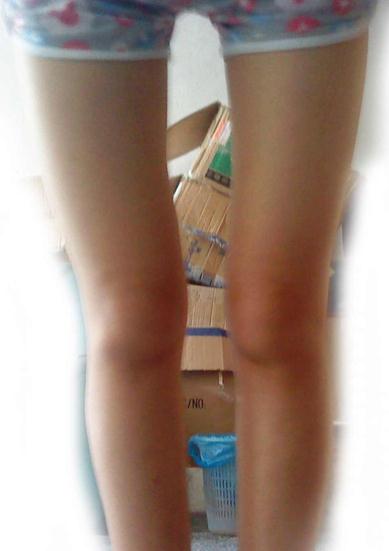 科普!有些大腿之間縫隙超大的女人完全是天生,與做那事OOXX無關(guān)(圖)