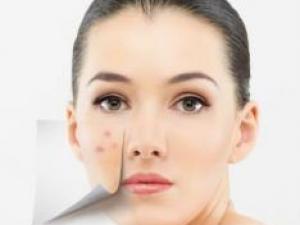 Ę���L������ʲôԭ��Ę���L������ô�{�����ഺ����ô����