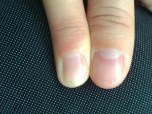 ��ָ���^���� ����ָ�������Q�y��ע���{��