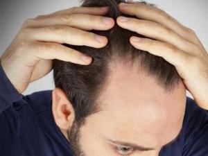 ��������Ó�l��ô�k����ʲôʳ�����A��Ó�l