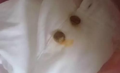 衣服上的鐵銹怎么洗?鐵銹用什么洗好