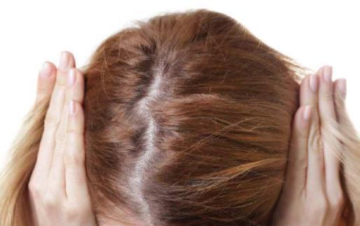 冬天天天洗頭發好不好 冬天洗頭怎么防止頭發干燥