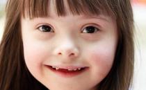 你了解唐氏癥嗎？ 唐氏癥有哪些癥狀？