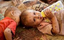 什么是霍亂？ 霍亂如何防治？