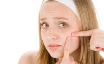 中醫如何治療學生痤瘡