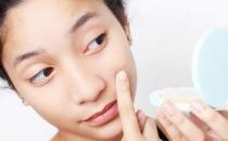 女孩兒必知的“戰痘”秘籍