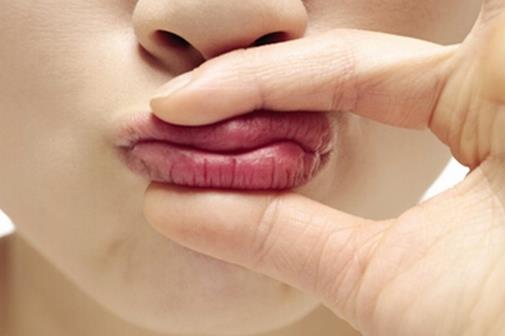 冬季嘴唇干裂如何預防 教你12招
