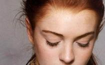 祛斑失敗的原因有哪些 如何應(yīng)對(duì)