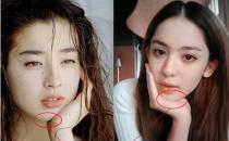 盤(pán)點(diǎn)90后喜歡的整形項(xiàng)目