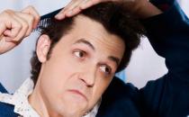 中年男性脫發怎么辦？