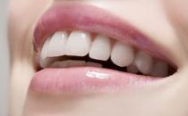 教你如何挑選烤瓷牙！