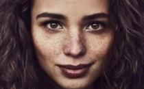 雀斑是如何形成的 找準原因去雀斑