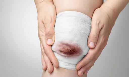 遇到外傷大出血要怎么辦?