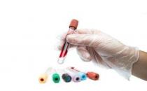 什么是血常規(guī)檢查？血常規(guī)化驗(yàn)單怎么看？