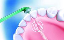 揭秘洗牙存在的認識誤區