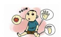 什么是手足口病？手足口病怎么治療