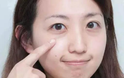 如何去眼袋 這些小妙招超管用
