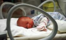 科學治療新生兒黃疸 新生兒出現黃疸學會這樣護理