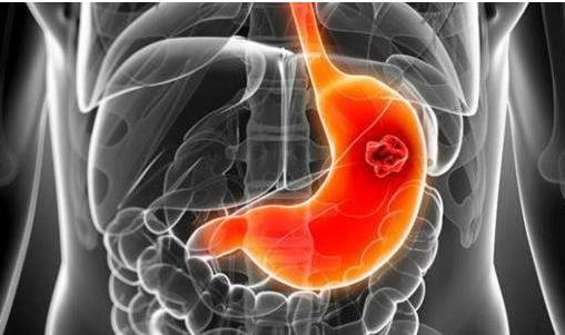 胃病三分治七分養 能養胃助消化的食物