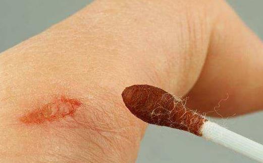 想要傷口愈合的快 日常飲食患者的心態等的注意事項