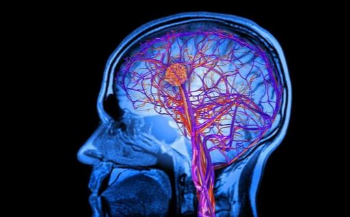 早上起床時，體外出現四個特征，很遺憾，腦出血可能已經找上你 