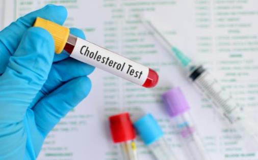 血脂總是上下波動？醫(yī)生：要注意這幾點，避免心腦血管出