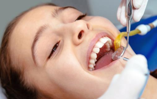 洗牙到底好不好?洗牙會傷牙嗎?