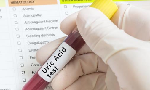 尿酸高需要吃藥的癥狀 尿酸高的日常控制法則