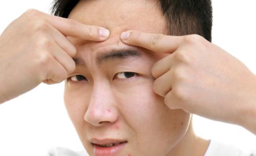 肌膚長痘痘 祛痘10大誤區(qū)應(yīng)避免