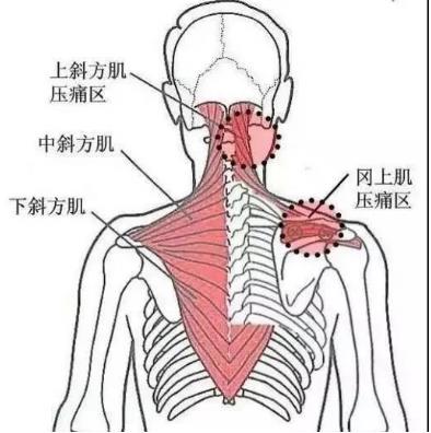 湛江崇愛康復(fù)醫(yī)院科普如何防治肌筋膜炎 以真誠(chéng)來服務(wù)患者