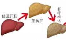 貴州治丙肝醫院靠不靠譜 貴州中醫肝病醫院質量醫療的踐行者