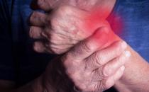 類風(fēng)濕關(guān)節(jié)炎日常護(hù)理法 鍛煉常做關(guān)節(jié)拉伸運動