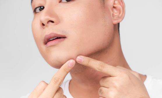 下巴長(zhǎng)痘痘怎么辦 祛痘小竅門(mén)