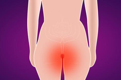 南充市東大肛腸醫院：科普痔瘡的分類及如何防治