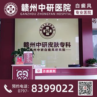 贛州白癜風醫(yī)院離火車站多遠 疫情期間白癜風患者怎么提高免疫力