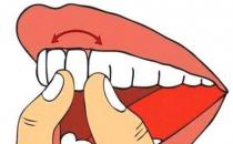 武漢種植牙價格，造成牙齒松動的常見原因？