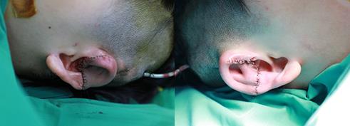 為愛圓夢給耳朵一次新生——記一場特殊的直播