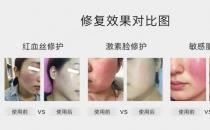 放心！有美薏升修復敏感肌紅血絲專家產品在，你每天都可以美美噠