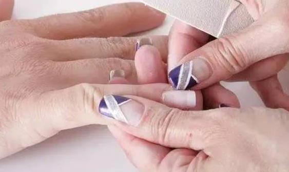 甲溝炎大部分竟是自己作出來的 甲溝炎預(yù)防成了關(guān)鍵