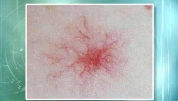 長(zhǎng)期睡前玩手機(jī)的人，面部若有3癥狀，可能是肝在“吐槽”